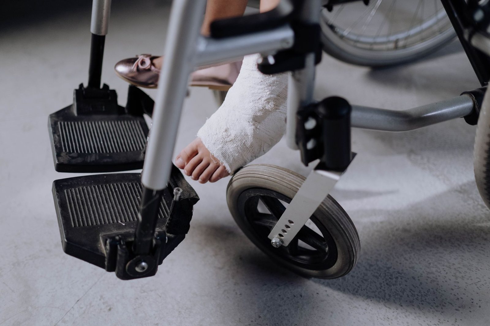 Pie lesionado con yeso apoyado en silla de ruedas.